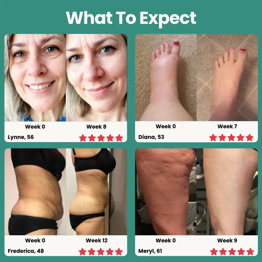 21-in-1 Lymphatic Drainage Softgels for Menopausal Women