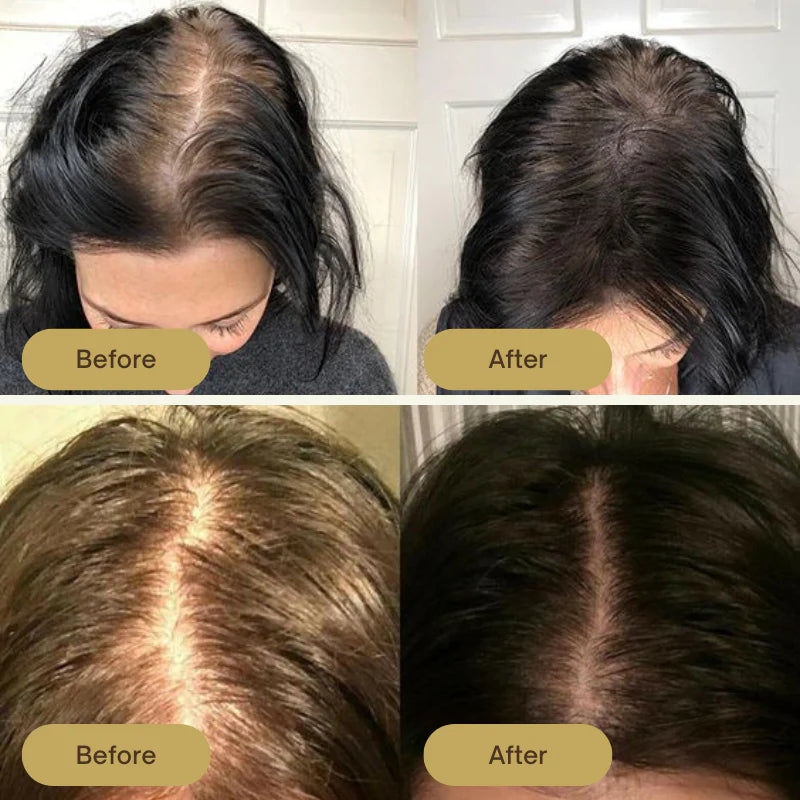 Healthley™ Natural Hair Growth Oil