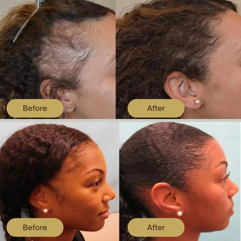 Healthley™ Natural Hair Growth Oil