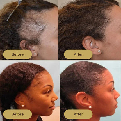 Healthley™ Natural Hair Growth Oil